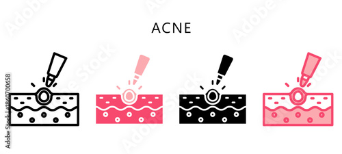 Acne Multi Style Icon. Mini Illustration Relate To Personal Care. Use For Modern Concept, Ui, Ux Web And App Development.