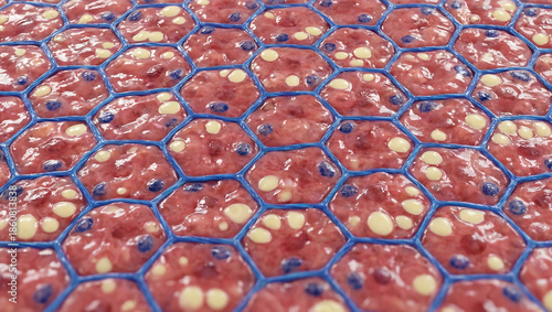 NASH Liver Spheroid: Chicken Wire Fibrosis Encasing Steatotic Hepatocytes (3D Organoid Model)