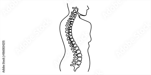 A single line drawing of the human torso and spine showing scoliosis curvature Vector, illustration