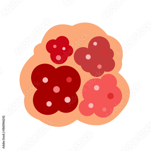 cancer tumor cell developing concept