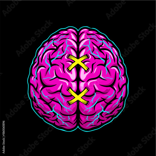 Stylized Human Brain Illustration with Yellow X Stitches