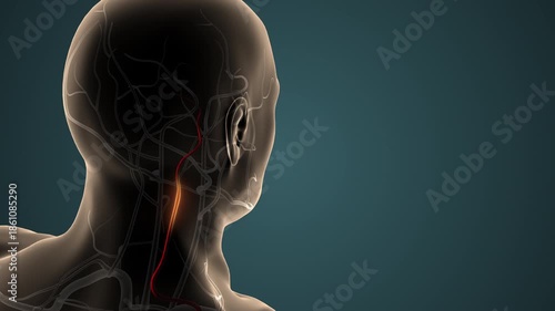 Aneurysm of the Cervical Carotid Artery