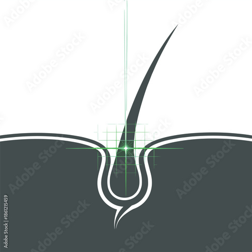 Stylized of a hair follicle with a green laser targeting it