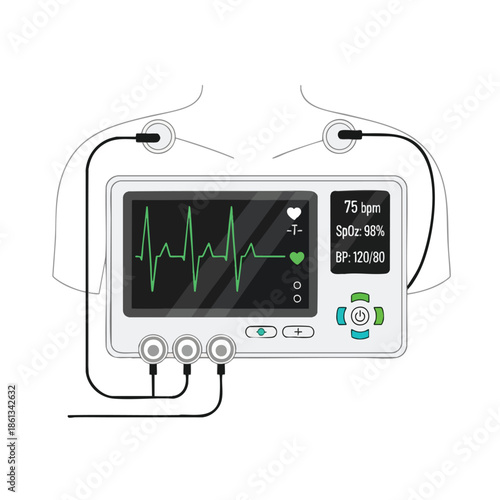A medical monitoring device showing vital signs, attached to a person’s torso