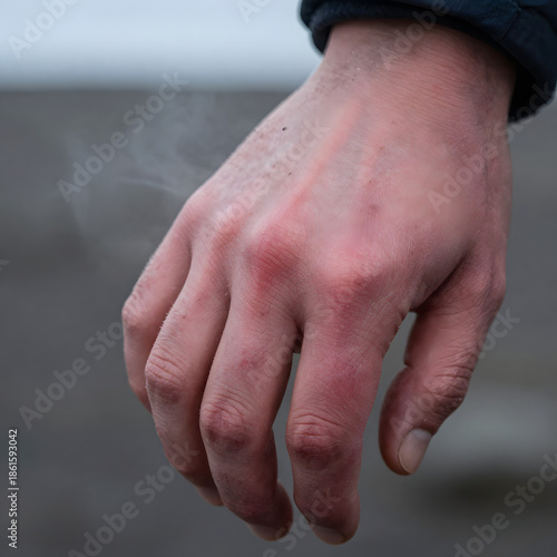 Close-Up of Human Hand with Visible Veins in Cold Weather Outdoor Environment,