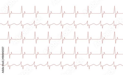 A repeating pattern of electrocardiogram heart rate lines on a white background.