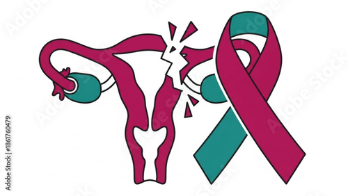 Uterus with ovaries and broken pieces, pink and teal ribbon, symbolizing women's health, cancer awareness, reproductive system, and gynecology, medical illustration