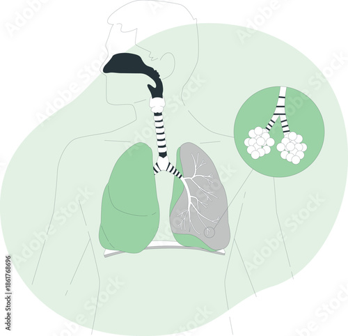 Detailed illustration of human lungs and trachea showcasing respiratory health from a rear viewpoint