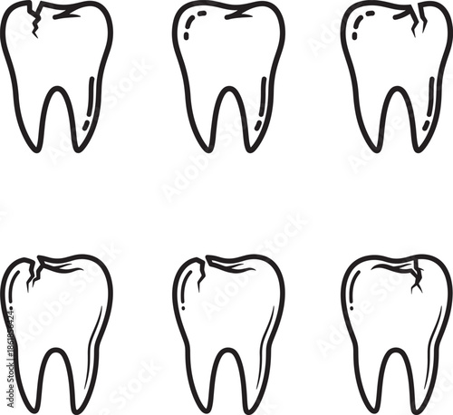 Illustration of six teeth from different angles