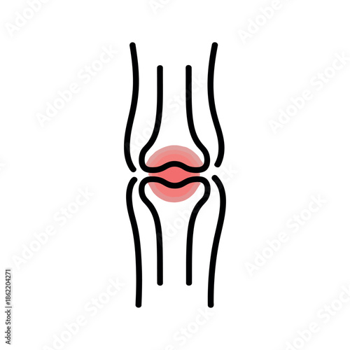 Knee joint diagram shows area of inflammation.