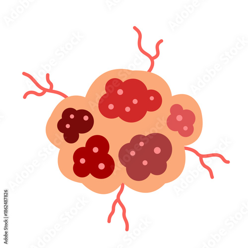 cancer tumor cell developing concept