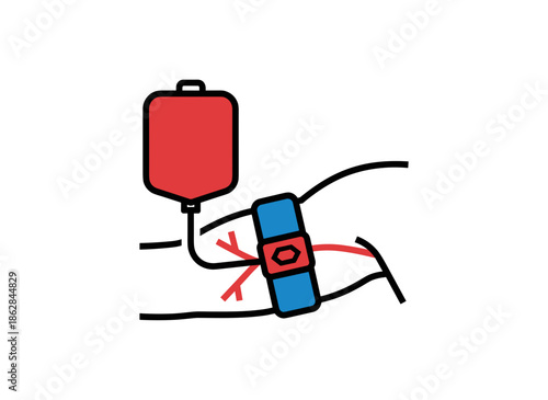 A blood donation sleeve on arm with collection bag isolated on white background concept of transfusion process