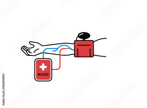 Blood donation process with sleeve and blood bag illustration