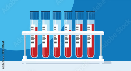 A row of six blood-filled test tubes with blue caps in a white rack against a blue background, representing medical laboratory testing and analysis.