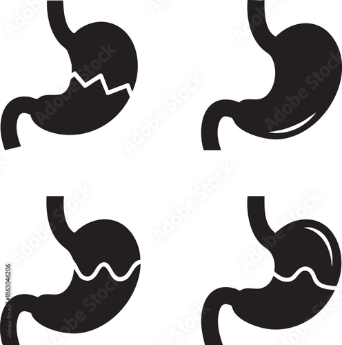 Illustrations of stomach anatomy with various ulcer representations