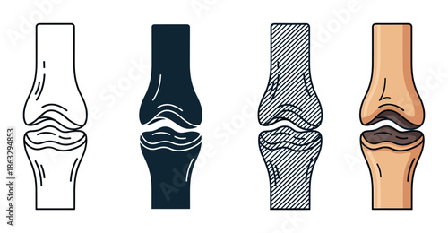 Four human bone joint icons presented in a set with different styles including outline, silhouette, hatched, and colored for medical or anatomical concepts