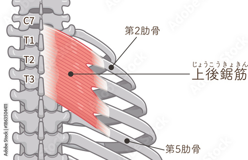 上後鋸筋のイラスト、Serratus Posterior superior illustration
