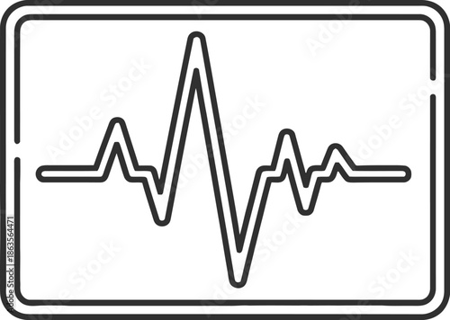Electrocardiogram reading on monitor screen