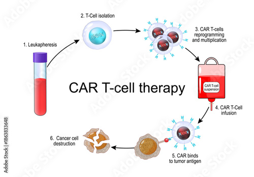 CAR T-cell therapy. Cancer immunotherapy. CAR-T cell for killing of tumor