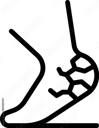 Dry cracked heel skin, moisturizing treatment, dermatological problems, foot health and hygiene