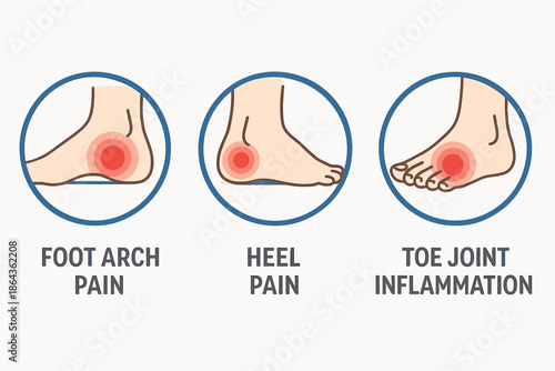 Common foot pain types illustrated: arch pain, heel pain, toe joint inflammation