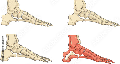 Konstfotografi Set of Four Human Foot Bone Anatomy Illustrations Side View Representing Medical