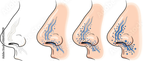 Set of Four Human Nose Anatomy Illustrations Side View Representing Respiratory Health Nasal Cavity Smell Sense Allergy Cold And Breathing