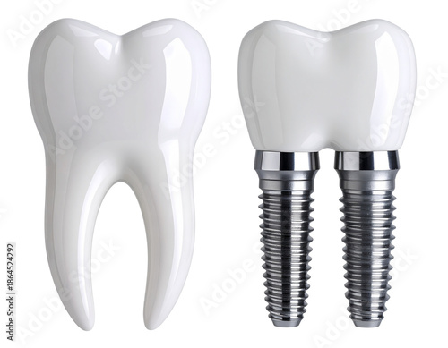 Dental Prosthetic Implant With Adjacent Teeth Duo, isolated on transparent background