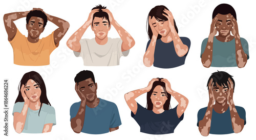 Diverse people with vitiligo expressing concern