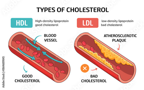 Types of Cholesterol Illustration Good and Bad Cholesterol