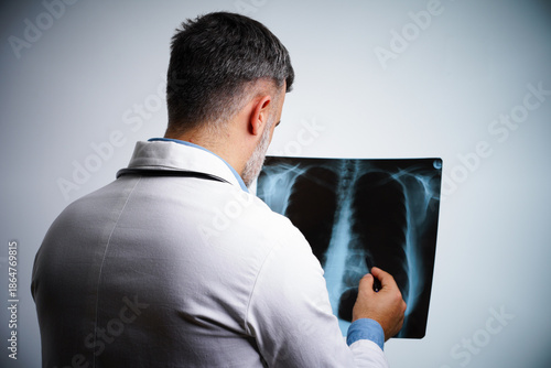 Man Doctor Analyzing X-Ray Scan Of Lungs In Clinic, Rear View.