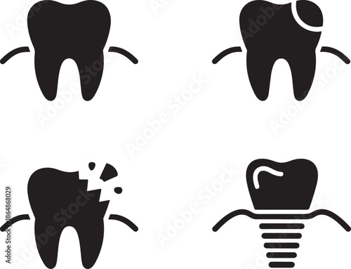 Illustrating Different Tooth Conditions from Healthy to Implant Supported