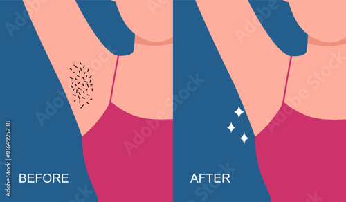 Before and after armpit hair removal