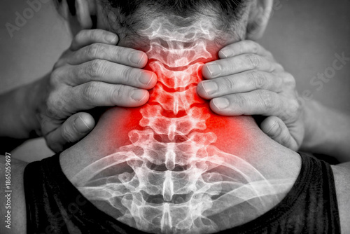 Neck and shoulder pain with cervical spine inflammation, hands holding neck 