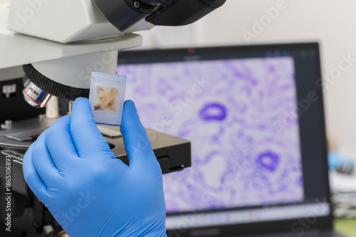 Scientist wear blue glove holding glasses slide and human tissue block, microscope and out of focus computer monitor show glandular image.Medical patholology and cytology laboratory technology concept
