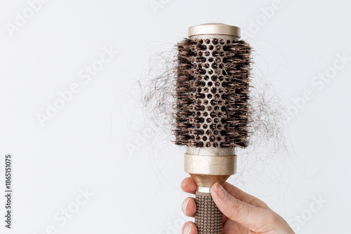 Bild auf Leinwand Close-up of round hairbrush with clumps of fallen hair, symbolizing hair loss caused by vitamin deficiency, low ferritin, protein shortage or hormonal imbalance