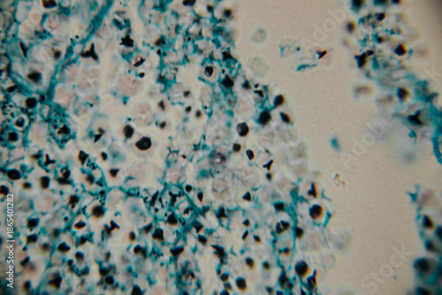 Microscopic view of stained fungal hyphae and spores with visible structures in blue against a beige background. Includes areas of blur and copy space.
