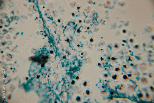 Microscopic view of stained fungal hyphae and spores with visible structures in blue against a beige background. Includes areas of blur and copy space.