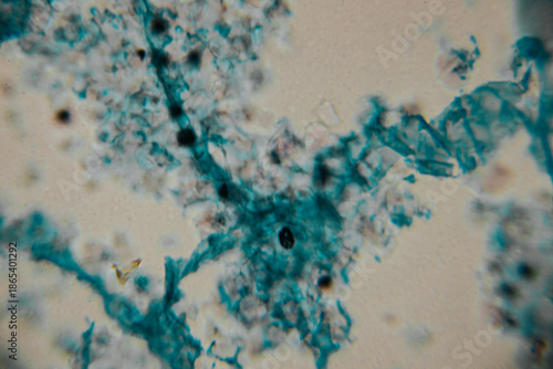 Microscopic view of stained fungal hyphae and spores with visible structures in blue against a beige background. Includes areas of blur and copy space.