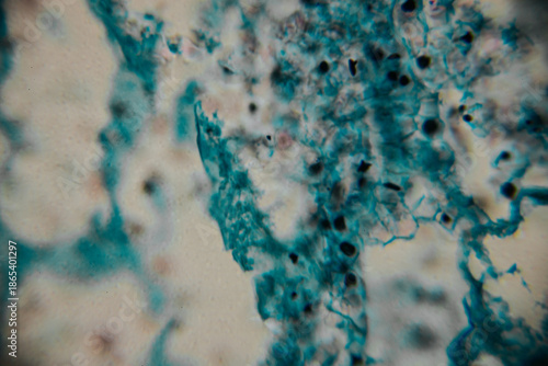 Microscopic view of stained fungal hyphae and spores with visible structures in blue against a beige background. Includes areas of blur and copy space.