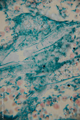 Microscopic view of stained fungal hyphae and spores with visible structures in blue against a beige background. Includes areas of blur and copy space.