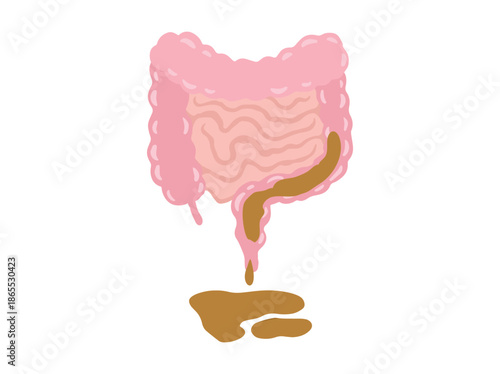 Hand Drawn Diarrhea Disease in Intestines
