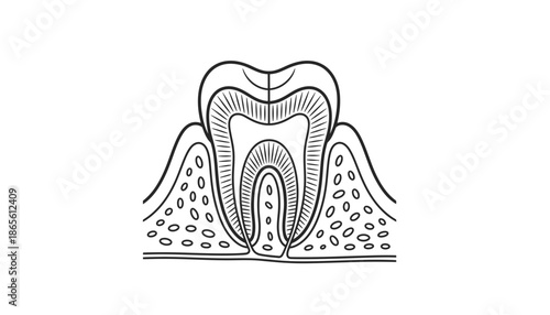 A detailed illustration of a tooth with its root and surrounding gum