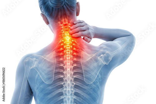 Human upper back and neck anatomy showing cervical spine inflammation pain affecting nerves muscles and vertebrae isolated on white background