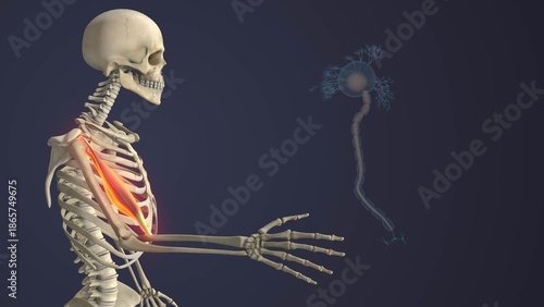 Motor Neuron Disease Causing Skeletal Muscle Weakness