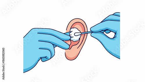 Close-up of hands in blue gloves cleaning an ear with a cotton swab