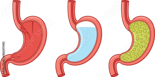 Human stomach anatomy vector illustration set showing empty liquid and food digestion stages isolated on white background
