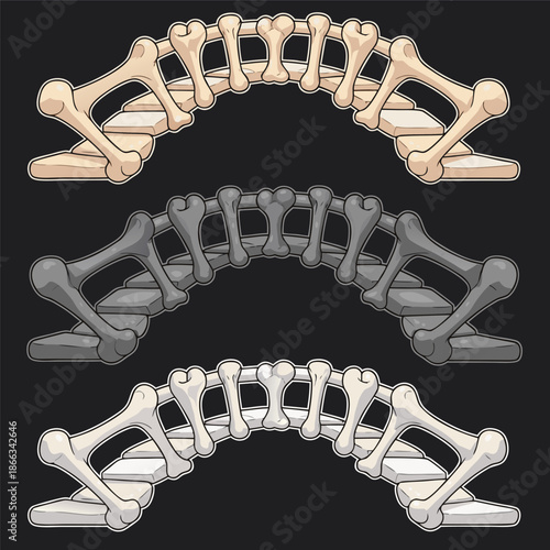 Bone Bridge Designs in Three Color Variations.