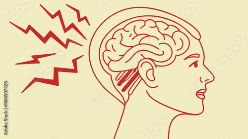 Headache migraine symbol, simple vector, line style SVG