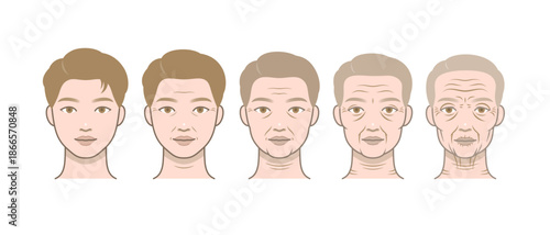 Male aging progression in five illustrated stages from youth to old age with increasing facial changes.